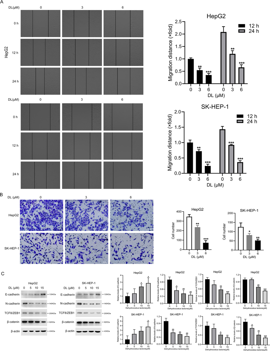 DL suppressed the migration ability and invasiveness of HCC cells. (A) Representative pictures obtained from the wound healing assay showing the migration ability of the two HCC cell lines at 0, 12 and 24 h after treatment with 0, 3 and 6 μM DL (20 × magnification). (B) Representative images of transwell assay showing the invasion of cells through Matrigel 24 h after treatment with 0, 3 and 6 μM DL (20 × magnification). (C) Immunoblots showing levels of EMT markers in the two HCC cell lines treated as indicated. *, ** and *** indicate P values<0.05, 0.01 and 0.001, respectively.