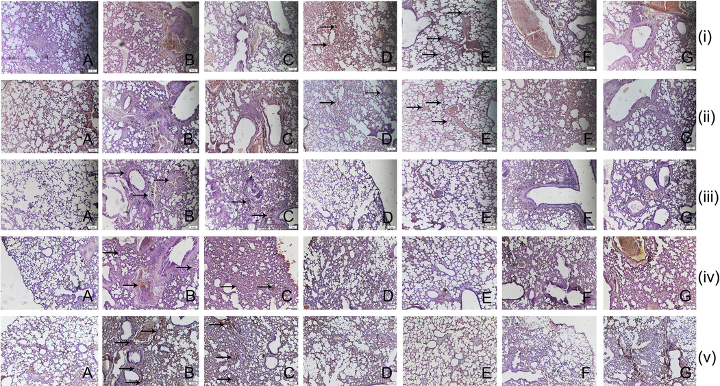 The immunohistochemical analysis of [i] p53 [ii] caspase-3, [iii] Akt, [iv] mTOR, and [v] β-catenin expression in the lung tissues at 10X magnification of (A) normal control, (B) carcinogen control, (C) 50 mg/kg complex, (D) 100 mg/kg complex, (E) 200 mg/kg complex, (F) 50 mg/kg taxifolin, and (G) 50 mg/kg ruthenium-p-cymene treated group, represented by black arrows.