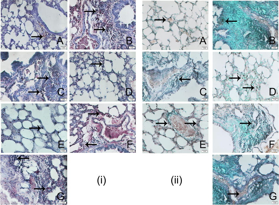 The immunohistochemical analysis of [i] Ki-67 expression and [ii] TUNEL-positive apoptotic cells in the lung tissue at 40X magnification of (A) normal control, (B) carcinogen control, (C) 50 mg/kg complex, (D) 100 mg/kg complex, (E) 200 mg/kg complex, (F) 50 mg/kg taxifolin, and (G) 50 mg/kg ruthenium-p-cymene treated group, represented by black arrows. Approximately 700 cells were counted per field, 10 fields were examined per slide.