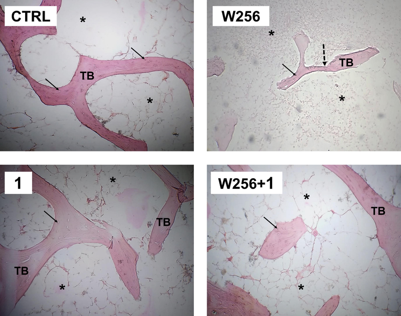 Bone histological micrograph of CTRL (A), W256 (B), 1(C), and W256 + 1(D) groups (magnification × 200). Walker 256/B breast cancer cells were intrafemoral inoculated and rats were euthanized 20 days after surgery. Note the advanced tumor osteolytic lesions (dotted arrow) and the trabeculae thinning in W256 and W256 + 1 groups per comparison with CTRL. Note also the less prominent tumor osteolytic lesions in the W256 + 1 group once compared with W256. TB: trabecular bone; Asterisks: intertrabecular spaces, which are occupied by hematopoietic lineage, adipocytes, and Walker 256/B cells (if any); Arrow: Osteocytes.