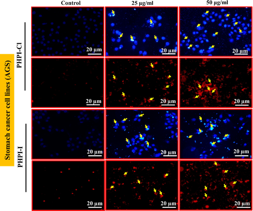 Hoechst and Propidium iodide (PI) staining of AGS cells. Arrow indicates the cell death after PHPI or PHPI-CI treatment. The experiment was carried out independently in triplicates and the represented images were shown.