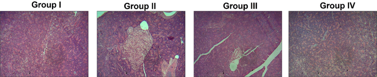 Outcome of Triptonide on the pancreas histopathology of the STZ induced DR rats. Triptonide on histopathology observation of normal and experimental rats. Group I: normal untreated demonstrates normal and regular ultrastructure, Group II: DR rats with STZ (60 mg/kg) exhibits disturbed islets with much gap in acinar cells in pancreas. Group III: Induced with STZ as well as with the 25 mg/kg of triptonide, showed reduced gaps between pancreatic acinar cells with excellent recovery of structure with intact of islet along with nucleus. Group IV: STZ induction along with treatment of metformin (300 mg/kg) in retinopathy animals also exposed the same intact nucleus and regular ultrastructure which was comparable with group I animals.