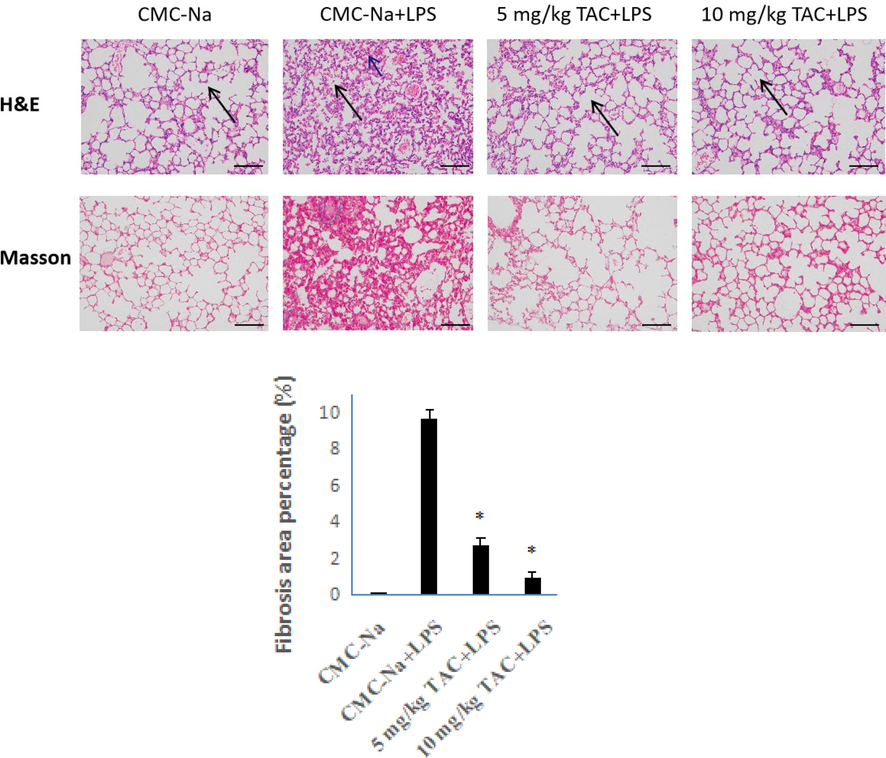 HE- and Masson-stained sections of the right upper lobe of ALI mice (x 200). The histogram is the proportion of fibrous tissue obtained from the analysis of Masson-stained samples, error bars indicate the means ± SD of three independent replicates. *P < 0.05 vs. placebo.