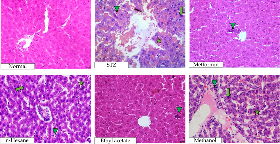 Histopathological images of liver after the administration of P. emblica extracts into STZ-induced diabetic rats. Necrosis, congestion, and inflammation are indicated by arrow (↑), star (★), and triangle (▲) symbols, respectively.