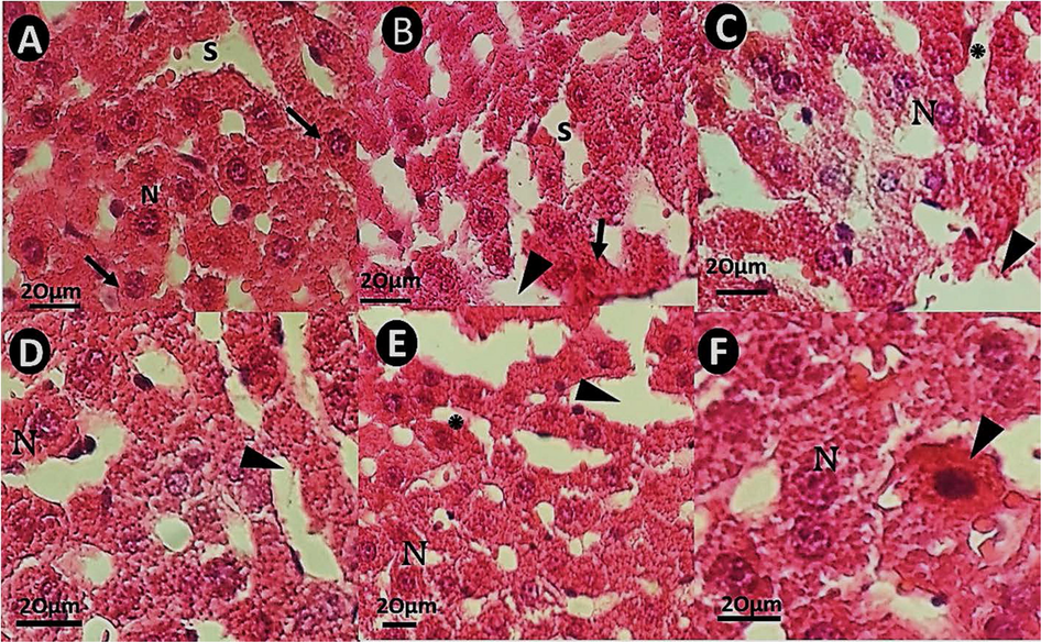 H&E staining pathology images of rat liver tissues (×40). The scale bar represents 20 μm. (A): hepatic section of a rat from control, with normal liver tissue and normal sinusoids (S); (B): hepatic micrograph of a rat received bulk IFO 0.1 mg/Kg, with pyknotic hepatocytes (arrow) and dilated sinusoids (arrowhead) without fibrosis; (C): hepatic section of a rat treated with bulk IFO 0.2 mg/kg. The arrow shows sinusoidal dilation; (D): Liver pathology images of a rat that received niosomal IFO (0.1 mg/kg showing normal sinusoids (arrowhead); (E): sinusoidal disarrangement in rats treated with niosomal IFO 0.2 mg/kg. (E&F: liver sections of rats treated with niosomal IFO 0.2 mg/kg) (F): necrosis of hepatocytes (arrowhead) and cytoplasmic condensation in rats treated with niosomal IFO 0.2 mg/kg.