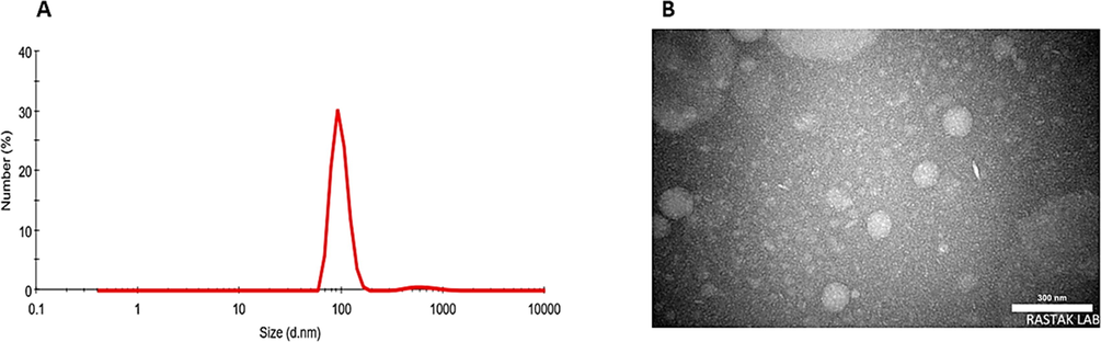 A) Particle size distribution measured by DLS; B) TEM image of niosomal IFO.