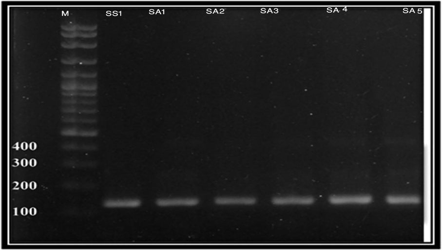 Molecular Identification of H. pylori using Hp1, Hp2 and Hp3.