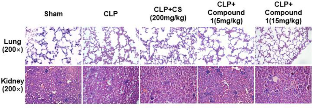 Effect of compound 1 on CLP-mediated organ injury in mice. Lung and kidney histopathology at post-operation 48 h from five groups; magnification: 200 ×.