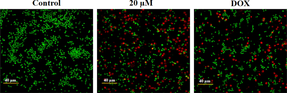 Effect of geraniol on the apoptosis in the C666-1 cells. The microphotographs of geraniol-treated C666-1 cells, which are analyzed by dual staining, revealed intense red fluorescence that demonstrates the occurrence of apoptotic incidences.