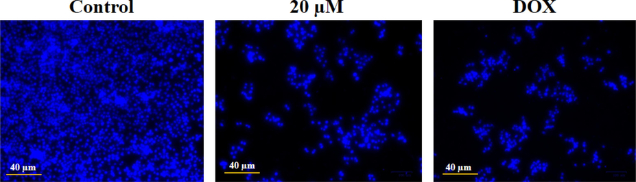 Effect of geraniol on the apoptotic cell nuclear damage in the C666-1 cells. The DAPI staining revealed that the geraniol treatment caused more cellular damage and the development of apoptotic bodies when compared to the control.