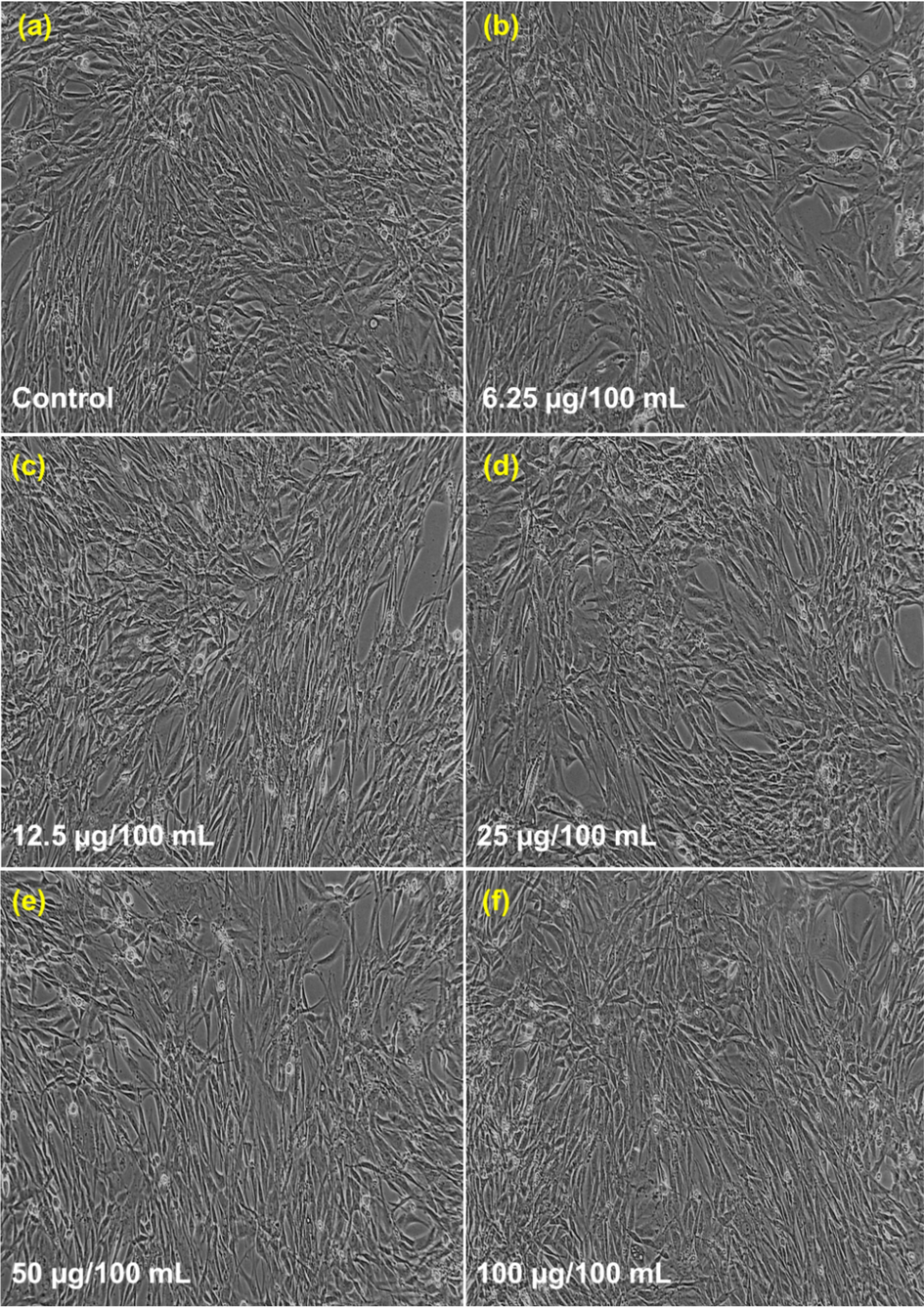 Cytotoxic results for CeNC@T1: (a) Control, (b)-(f) Different concentrations of CeNC@T1 (6.25–100 µg/mL) incubated with L6 cell line.