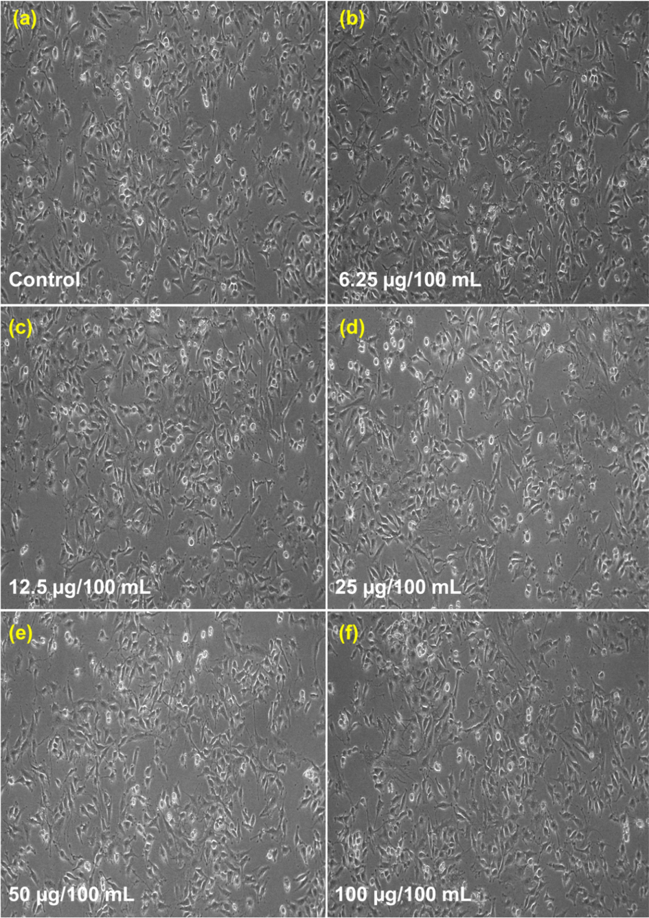 Cytotoxic results for CeNC@T2: (a) Control, (b)-(f) Different concentrations of CeNC@T2 (6.25–100 µg/mL) incubated with L6 cell line.