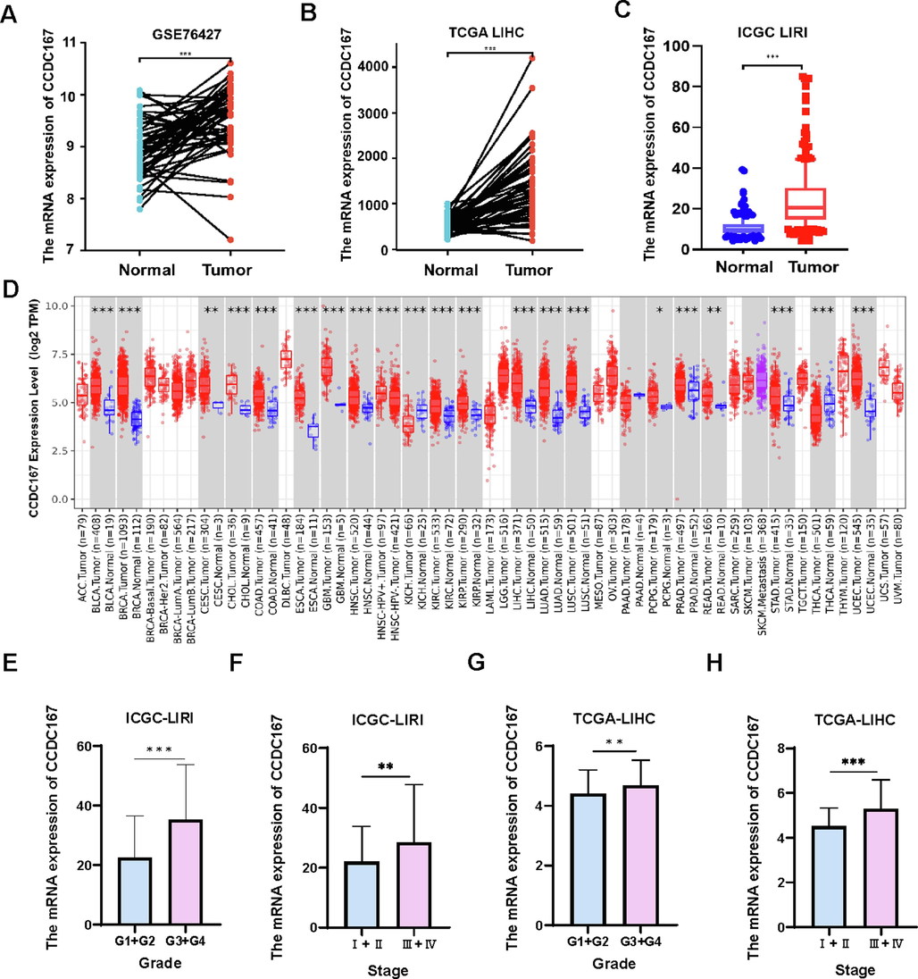 Expression of CCDC167 and its relationship with clinical features of hepatocellular carcinoma. (A) CCDC167 expression in paired normal and hepatocellular carcinoma tissues (GSE76427). (B) Expression of CCDC167 in paired normal and liver cancer tissues (TCGA-LIHC). (C) Expression of CCDC167 in the ICGC-LIRI liver cancer dataset. (D) CCDC167 expression in multiple cancers from TIMER 2.0. (E-H) Relationship between CCDC167 in ICGC-LIRI and TCGA-LIHC and clinical grade and stage of patients with hepatocellular carcinoma. ***P < 0.001, **P < 0.01, *P < 0.05.