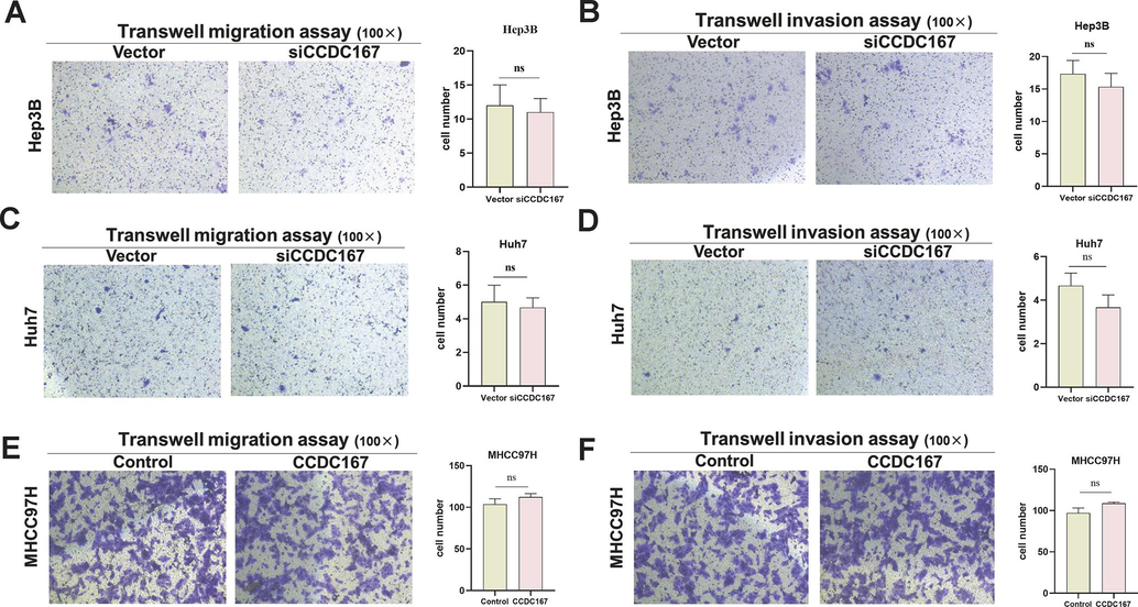 CCDC167 does not affect the migration and invasive ability of hepatocellular carcinoma cells. (A, C, E) Transwell migration assay for cell migration ability. (B, D, F) Transwell invasion assay for cell invasion ability.