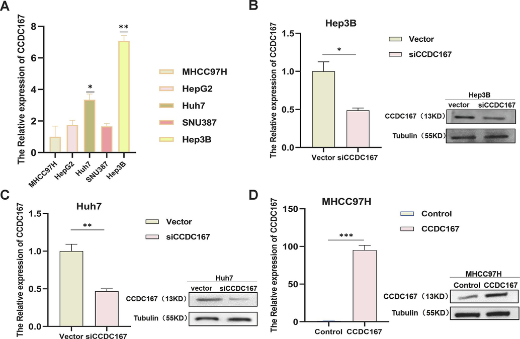 PCR and WB to detect the expression of CCDC167. (A) PCR to detect CCDC167 expression in five hepatocellular carcinoma cell lines. (B-D) PCR and WB to detect transfection efficiency.