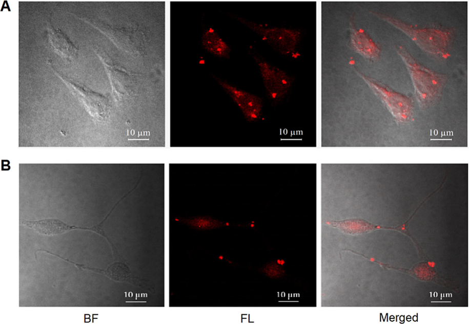 The uptake of NPs in cancer cells. (A) AGS cells and (B) CT26 cells were cultured with RITC-labeled NPs (100 μg/mL) for 24 h. Bright field (BF), fluorescence (FL) and merged images were captured by a confocal fluorescence microscope with magnification x600. Scale bar 10 μm.