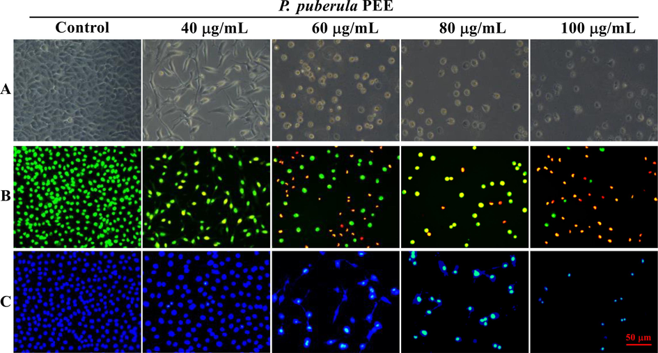 The morphological changes of A549 cells exposed to various doses of P. puberula root PEE. (A) The A549 cells' morphological alterations under phase contrast microscope. (B, C) After staining with AO/EB (B) and Hoechst 33,258 (C), morphological changes of nuclei were observed under an inverted fluorescence microscope.