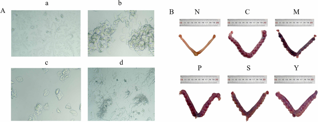(A) Micrograph of rat vaginal smear. (Light microscopy, 10 × ): (a) Interestrus, (b) oestrus, (c) late oestrus, (d) Vaginal sperm smear in rats; (B) Morphology of rat uterus: (N) Normal; (C) Control; (M) Model; (P) Progesterone group; (S) raw products of Semen Cuscuta group; (Y) Semen Cuscutae processed with salt solution group.