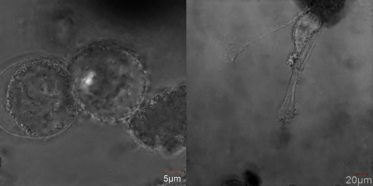 Confocal images of MCF-10A cells treatment with doxorubicin (left) and doxorubicin loaded into core-shell microgels (right).