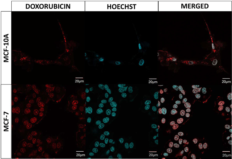 Confocal images of MCF-10A and MCF-7 cell lines after 72 h of treatment with DOX + CS. The nuclei of cells were stained with fluorescent dye - Hoechst, resulting in a blue color. For each cell line, the figure presents separate fluorescent signals as well as a merged signal. The red color represents the fluorescence emitted by doxorubicin. Please refer to the web version of this article for a detailed interpretation of the references to color in the figure legend. (For interpretation of the references to color in this figure legend, the reader is referred to the web version of this article.)