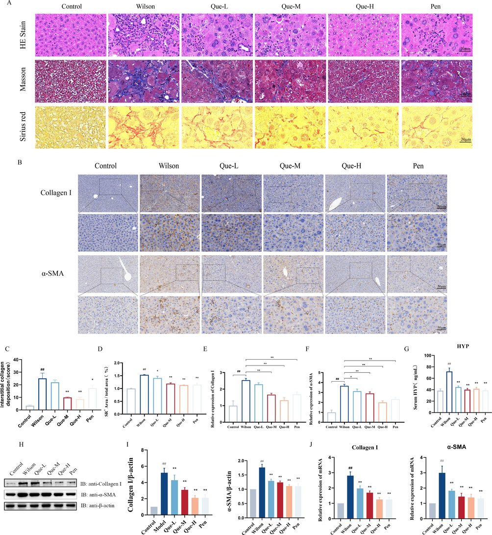 Effect of Que on liver fibrosis in TX mice. (A) Liver HE staining (magnification × 400, scale bar = 20 μm); using Masson staining (magnification × 400, scale bar = 20 μm); using Sirius scarlet staining (magnification × 400, scale bar = 20 μm). (B) Immunohistochemical staining of liver tissue for Collagen I and α-SMA (magnification × 200, scale bar = 50 μm). (C-D) Statistical analysis of the extent of collagen deposition and morphometric quantification of the SR-positive area in the liver tissues of each group. n = 3. (E-F) The ratio of Collagen I, α-SMA positive cells / total cells in liver tissues was determined, n = 3. (G) Serum HYP level, n = 6. (H-I) Quantification of Collagen I and α-SMA in liver tissues. The protein expression of Collagen I and α-SMA. Relative protein levels were normalized by β-actin, n = 3. (J) The mRNA expression of Collagen I and α-SMA in liver tissue. n = 6. #P < 0.05, ##P < 0.01, vs. Control, *P < 0.05, **P < 0.01, vs. Wilson. Data are expressed as mean ± SD.