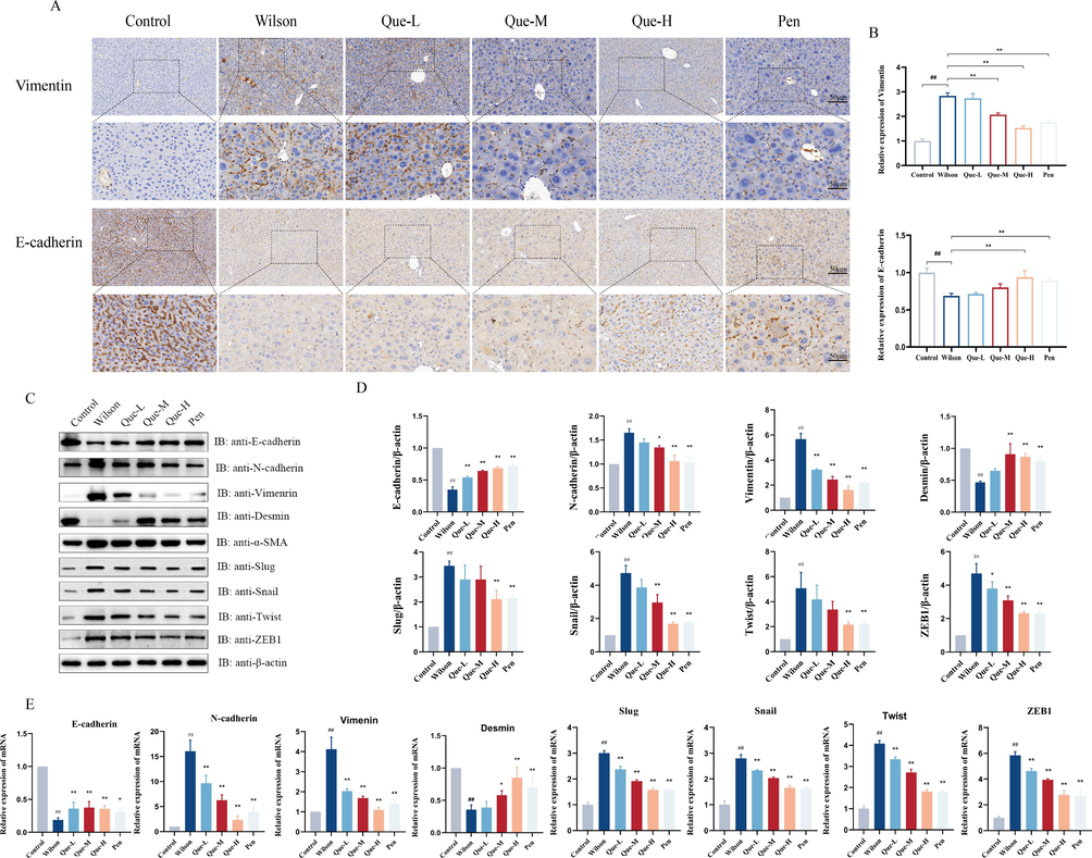 Effects of Que on the EMT in the liver tissues of TX mice. (A) Immunohistochemical staining for Vimentin, E-cadherin expression, (magnification × 200, Scale bar = 50 μm). (B) the ratio of Vimentin, E-cadherin positive cells / total cells was determined in the liver tissue, n = 3. (C- D) Protein expression of EMT signaling pathway, E-cadherin, N-cadherin, Vimentin, Desmin, Slug, Snail, Twist, ZEB1, and relative protein levels were normalized by β-actin, n = 3 (E) The mRNA expression of E-cadherin, N-cadherin, Vimentin, Desmin, Slug, Twist, ZEB1, Snail, Twist, ZEB1, n = 6. #P < 0.05, ##P < 0.01, vs. Control, *P < 0.05, **P < 0.01, vs. Wilson. Data are expressed as mean ± SD.