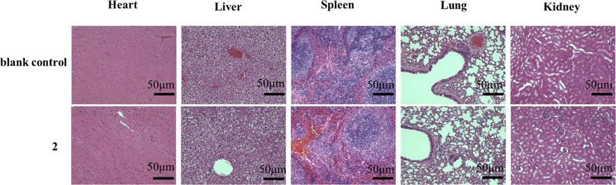 H&E staining histological sections of heart, liver, spleen, lung and kidneys at 21 days after treatment of mice with 2 (1.96 × 10-5 mol/kg/day) or 0.9 % sodium chloride (blank control). Images were taken with a Leica microscope. Magnification, 400 ×. Scale bar = 50 μm.