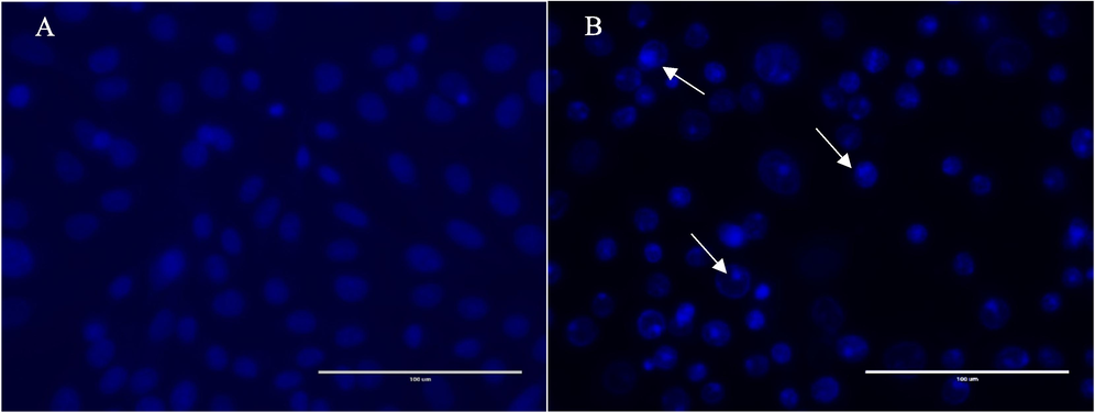 Nuclear staining using DAPI of HepG2 cells in the presence or absence of the of the F5 fraction of H. curassavicum. (a) Untreated HepG2 cells, (b) HepG2 cells treated with 70 µg/mL of the F5 fraction for 24  h. White arrows indicate nuclear fragmentation margination of the nucleus and cell shrinkage, all associated with the apoptotic mode of cell death.