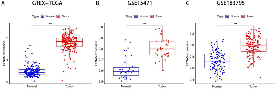 A. Analysis of EFNA5 expression in pancreatic cancer tissues (n = 179) and normal tissues (n = 175) based on the GTEX and TCGA databases. B. Analysis of EFNA5 expression in pancreatic cancer tissues (n = 36) and adjacent non-cancerous tissues (n = 36) in the GSE15471 dataset. C. Analysis of EFNA5 expression in pancreatic cancer tissues (n = 139) and adjacent non-cancerous tissues (n = 102) in the GSE15471 dataset.