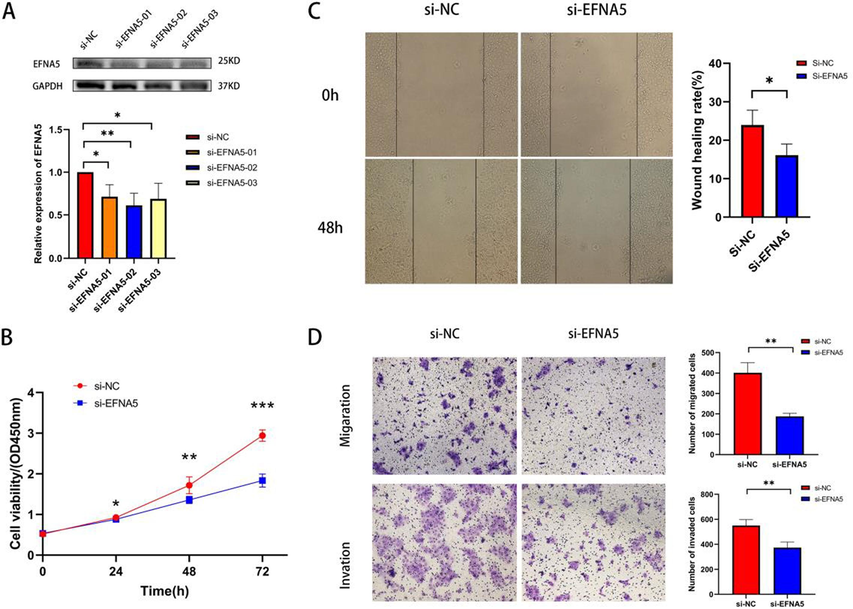 A. Western blot experiment to detect knockdown efficiency. B. CCK8 assay to assess the impact of EFNA5 knockdown on the proliferation ability of BxPC-3 cells. C. Wound healing assay to evaluate the effect of EFNA5 knockdown on the migration ability of BxPC-3 cells. D. Transwell assay to examine the effect of EFNA5 knockdown on the migration and invasion abilities of BxPC-3 cells.