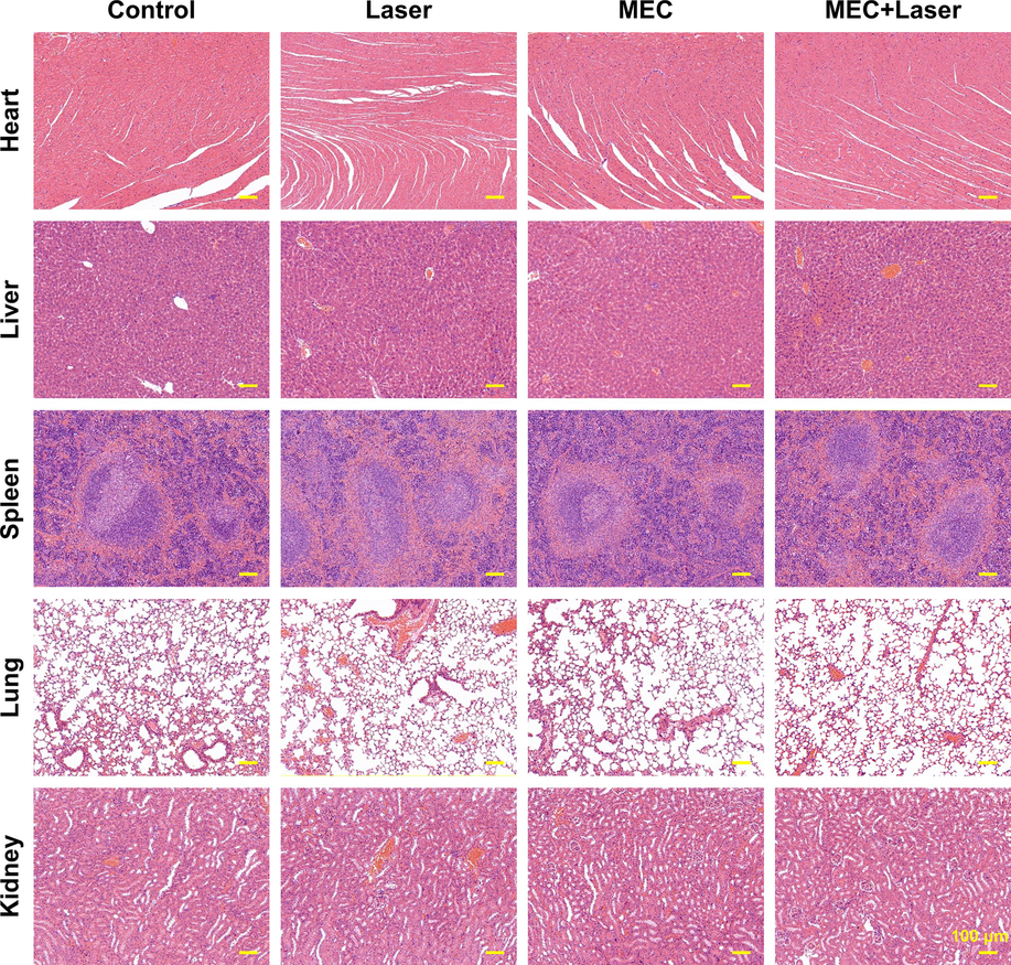 HE staining of major organs (Heart, Liver, Spleen, Lung, and Kidney) in mice after different treatments.