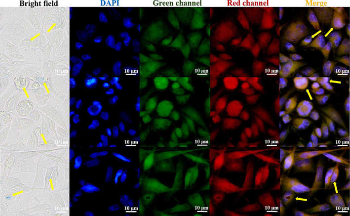 Fluorescence imaging of LFC fluorescent complexes in different channel Hela cells.