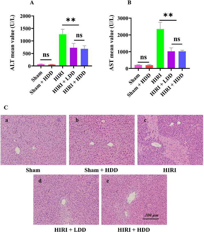 Effect of DD on AST, ALT and HE in HIRI mice.