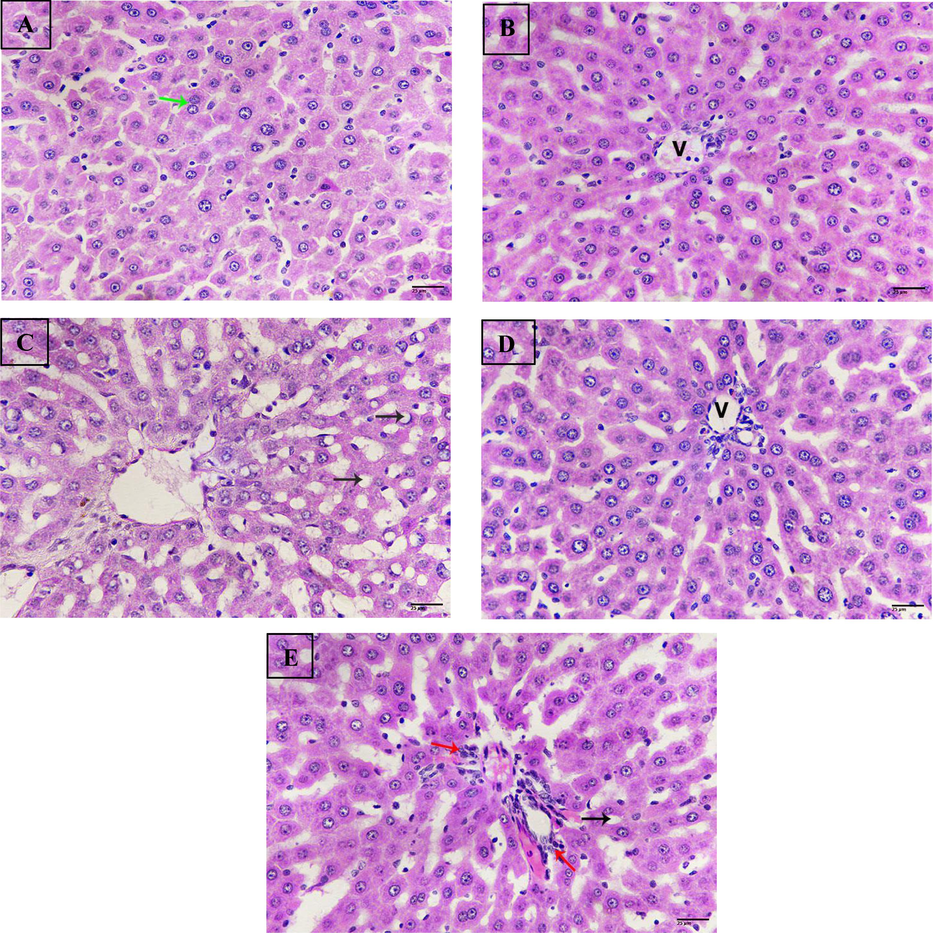 Photomicrograph of liver sections. (A) Sections from untreated control liver showing normal structure, binucleated cells (green arrow). (B) Sections of rat liver treated with nano hesperetin revealing normal structure, central vein (V). (C) Sections from rat liver treated with bisphenol A exhibiting severe steatosis (black arrows). (D) Sections from rat liver treated with BPA + hesperetin displaying normal tissue, vein (V). (E) Sections of rat liver treated with bisphenol A + nano- hesperetin showing improvement, less steatosis (black arrow), inflammatory cells (red arrows). (H&E-400X)(scale bar 25 µm.).