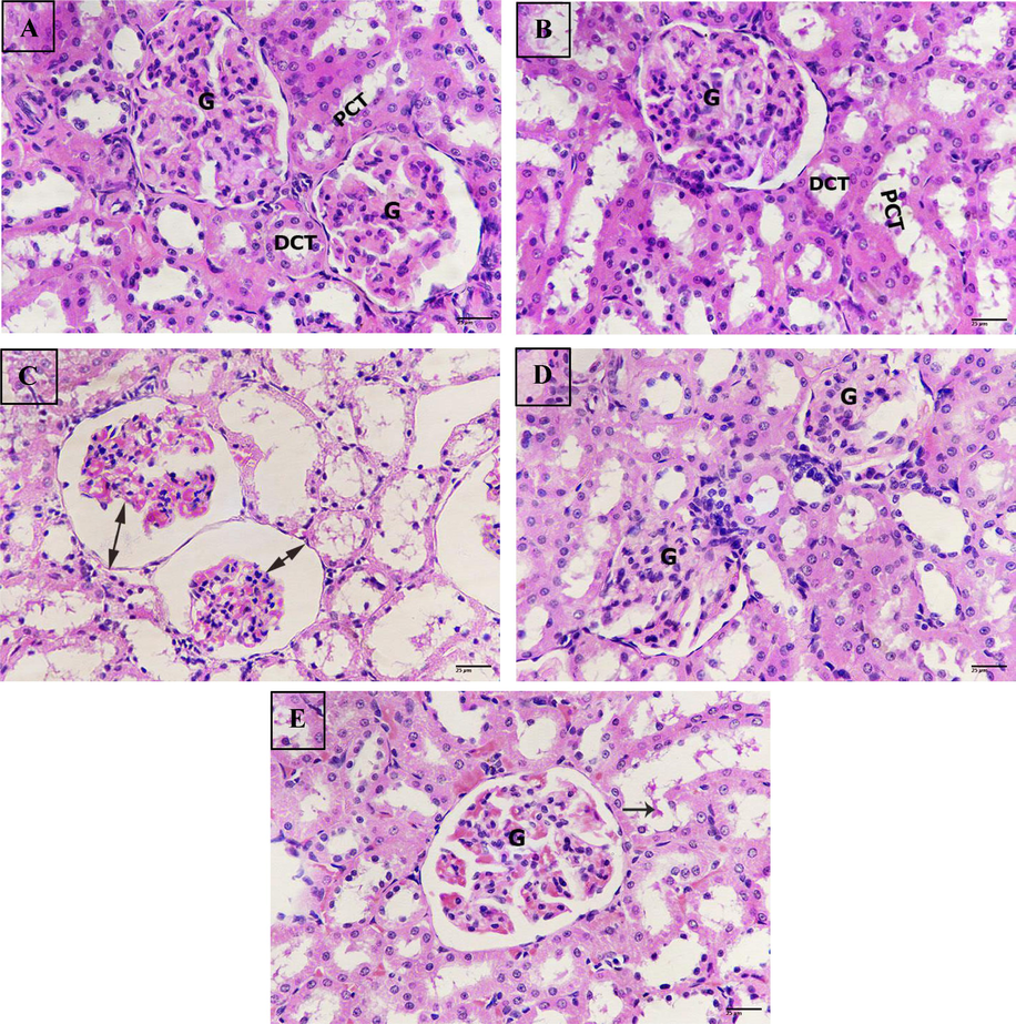Photomicrograph of kidney sections. (A) Sections from untreated control renal tissue displaying normal structure, glomerulus (G), proximal convoluted tubules (PCT), distal convoluted tubules (DCT). (B) Sections of rat kidney treated with nano hesperetin showing healthy structure, glomerulus (G), proximal convoluted tubules (PCT), distal convoluted tubules (DCT). (C) Sections of rat kidney treated with bisphenol A revealing severe degeneration, increasing of the glomerular space (double headed arrows). (D) Sections of rat kidney treated with bisphenol A + hesperetin displaying marked improvement, glomerulus (G). (E) Sections from rat kidney treated with bisphenol A + nano hesperetin posting some improvement, glomerulus (G), tubular cast (black arrow). (H&E-400X))(scale bar 25 µm.).