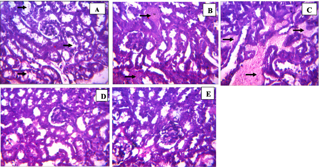 Histology of kidney sections from test animals treated with benzamide compound (9b): (A) 100 mg/kg, (B) 200 mg/kg, (C) 400 mg/kg, (D) 2000 mg/kg, (E) Control (Magnification ×400).