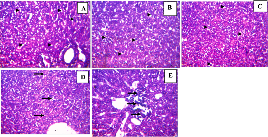Histology of liver sections from test animals treated with benzamide compound (9b): (A) 100 mg/kg, (B) 200 mg/kg, (C) 400 mg/kg, (D) 2000 mg/kg, (E) Control (Magnification ×400).