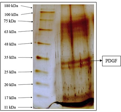 Qualitative and quantitative analysis of PDGF Fig. 1 denotes the qualitative and quantitative analysis of isolated PDGF. Gel image shows the qualitative confirmation of PDGF by SDS PAGE - silver staining method. PDGF bands was observed in 33 KDa.