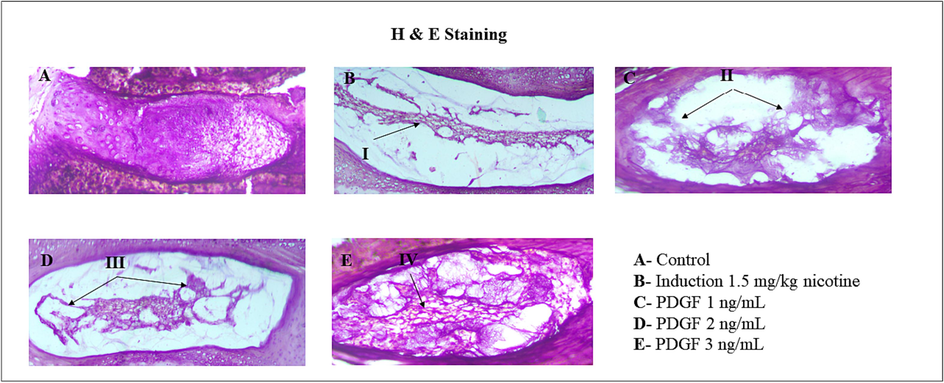 Histopathological analysis of IVD disc Fig. 4 showed the histopathological analysis of IVD disc in BALB/c mice. I – showed degeneration of NP disc matrix and less cartilaginous structure. II – indicates less NP cells and recovering cartilaginous structure. III – indicates regeneration of NP disc matrix and cartilaginous structure. IV – indicates regenerated disc matrix and cartilaginous structure was observed in high dose.