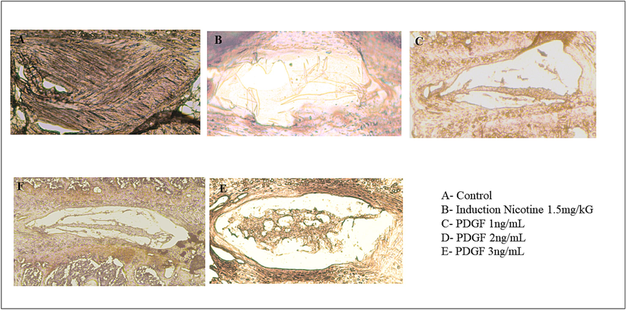 Immunohistochemistry analysis Fig. 5 showed the immunohistochemistry staining of Collagen II of IVD disc. There was loss of NP cells in induction group (5B), and the increased regeneration of NP cells was observed in dose dependent manner (5C, 5D and 5E).