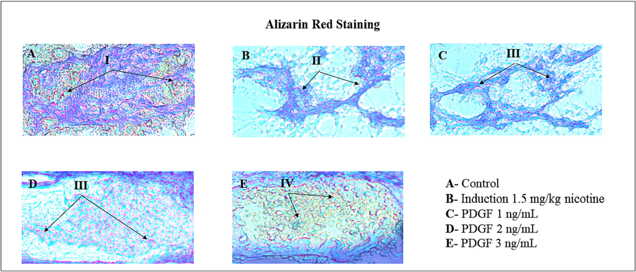 Calcium deposition by Alizarin red staining method Fig. 6 showed the images of Calcium mineralization in IVD disc by Dahl’s Method. I – indicates reddish orange color shows the Calcium deposition. II – indicates reduced NP disc matrix and cartilaginous structure and also low level Calcium accumulation. III – indicates regeneration NP disc matrix, cartilaginous structure and increased level of Calcium deposition as dose dependent manner. IV- indicates the progressive regeneration of disc matrix with high level of Calcium deposition.