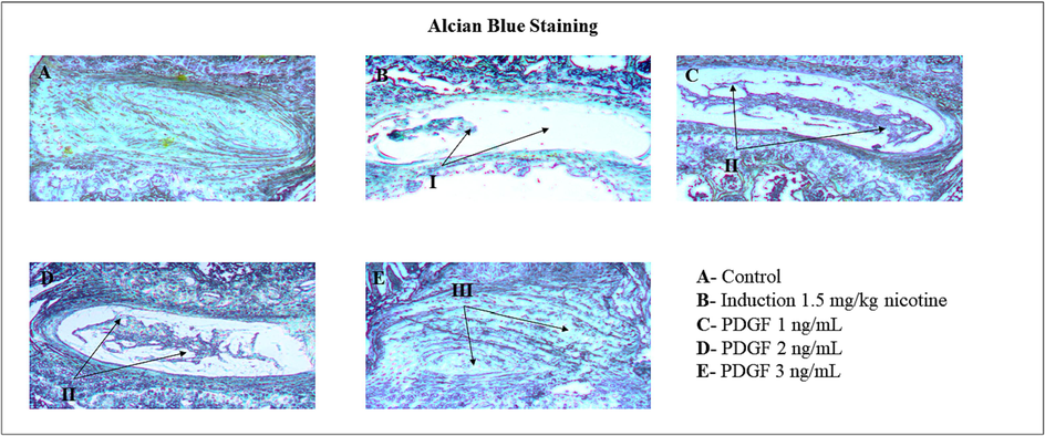 Alcian blue staining of mucilage tissues of IVD disc Fig. 7 showed the Alcian blue staining of mucilaginous tissues of IVD disc. I – indicates degeneration of NP disc matrix and less cartilaginous structure. II and III – indicates regeneration of NP disc matrix and cartilaginous structure.