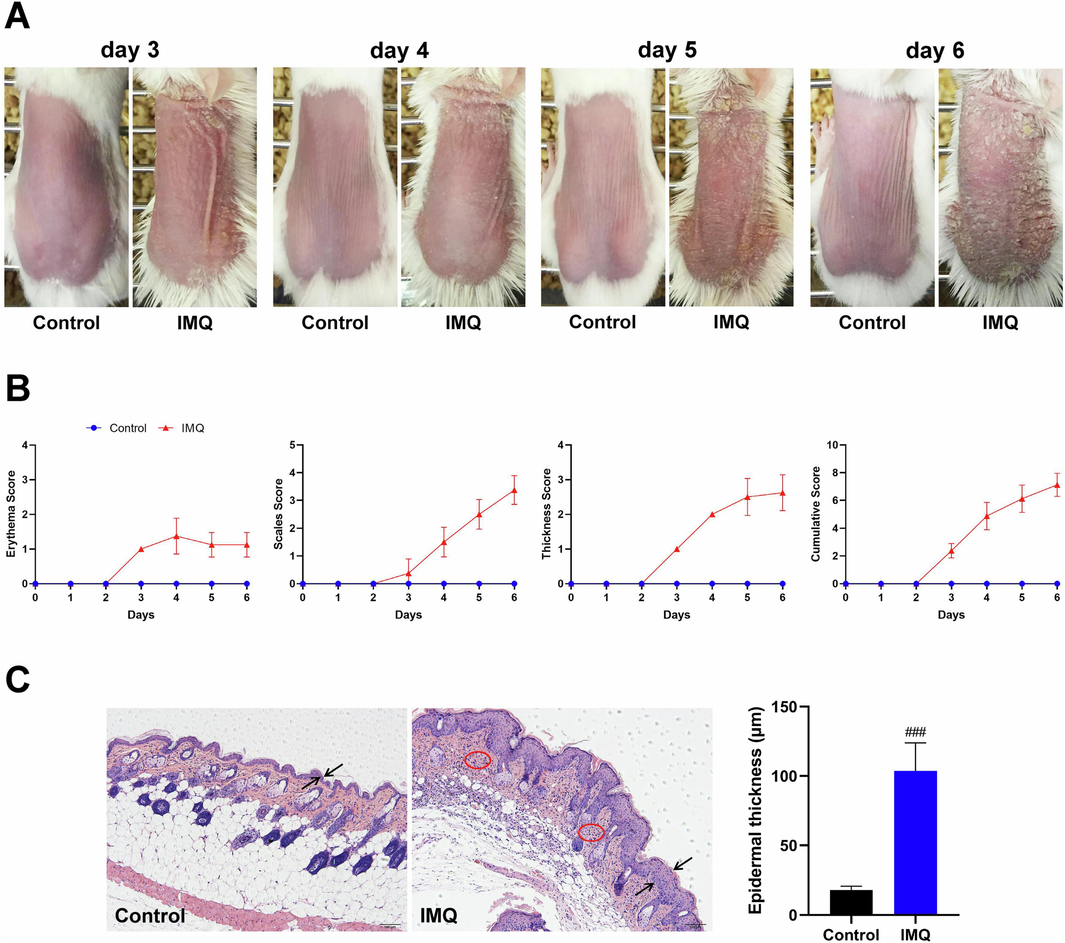 The phenotype of skin lesions in mice with IMQ-induced psoriasis-like dermatitis. (A) Representative pictures of dorsal skin between Control and IMQ groups during the experimental period from day 3 to day 6 when IMQ-induced skin lesions occurred (n = 8). (B) Evaluating the severity of skin lesions by PASI score including erythema score, thickness score, scales score and cumulative score (n = 8). (C) Histopathological observation of skin lesions by HE staining (scale bar, 100 μm) and morphometric analysis by Image-Pro Plus 6.0 software (n = 8). Two opposite arrows indicated the epidermis and red circle indicated the inflammatory cell infiltration. Data are expressed as mean ± SD. ###P < 0.001 versus Control group according to Student's t test.