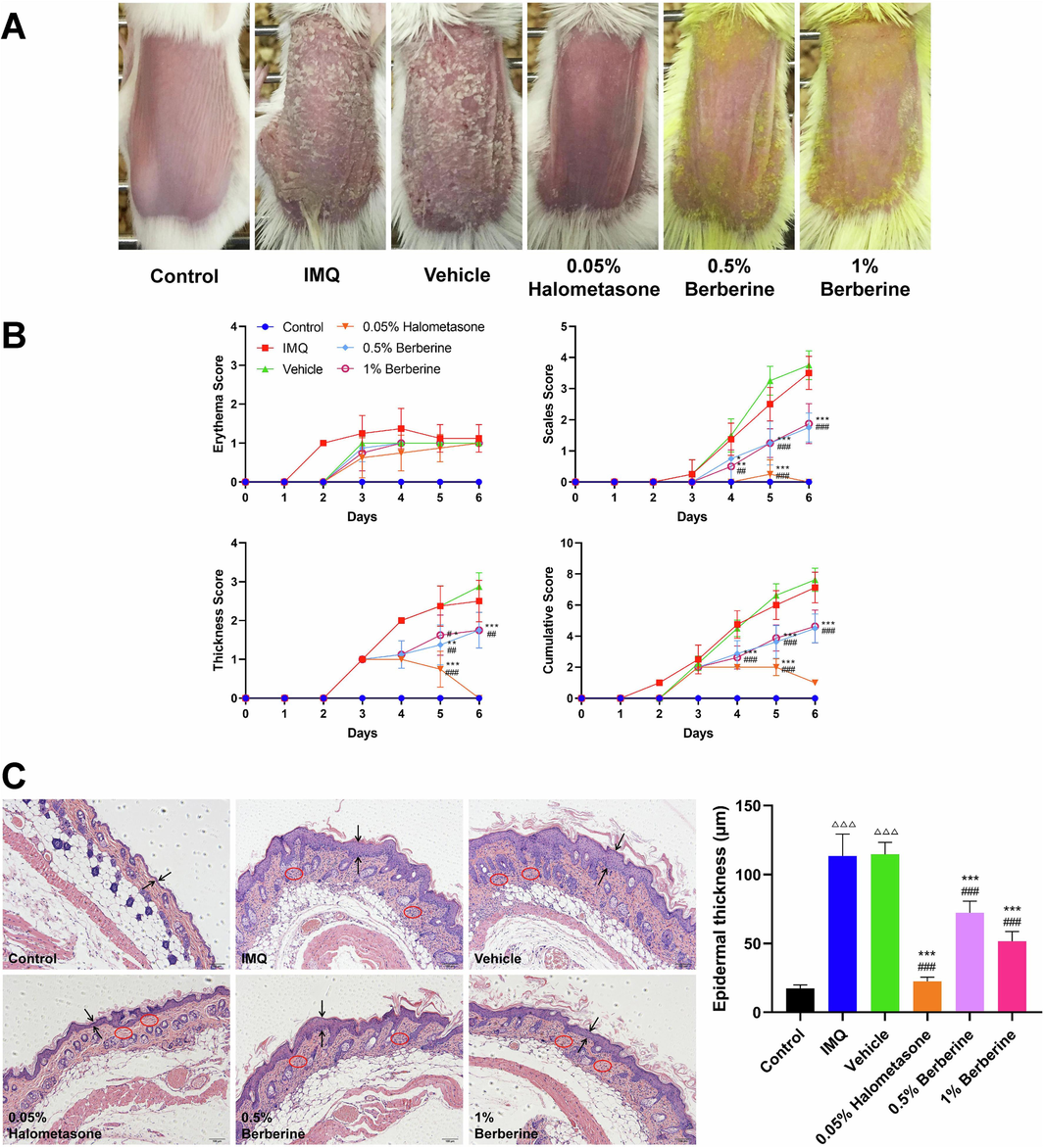 Topical application of berberine ameliorated IMQ-induced skin lesions. (A) Representative photographs of dorsal skin in IMQ-induced mice after 6 days for topical application of berberine (n = 8). (B) Assessment of the severity of skin lesions by PASI score including erythema score, thickness score, scales score and cumulative score (n = 8). (C) Topical application of berberine could decrease epidermal thickness and alleviate inflammatory cell infiltration in skin lesions (scale bar, 100 μm) (n = 8). Two opposite arrows indicated the epidermis and red circle indicated the inflammatory cell infiltration. Data are represented as mean ± SD. △△△P < 0.001 versus Control group, ###P < 0.001 versus IMQ group and ***P < 0.001 versus Vehicle group according to one-way ANOVA analysis followed by Sidak's multiple comparison test.