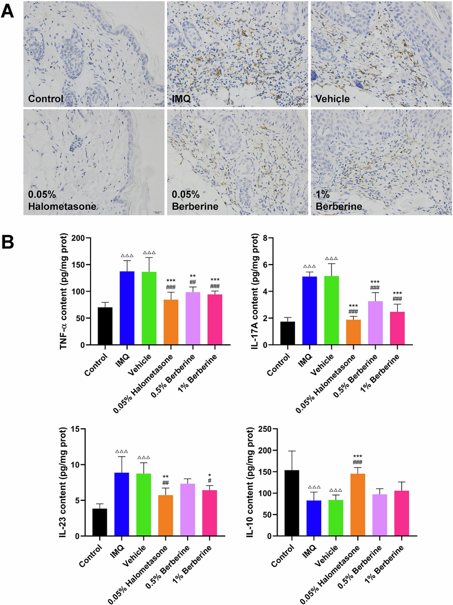 Topical application of berberine decreased the macrophage infiltration, reduced the release of inflammatory factor and increased the level of anti-inflammatory cytokine in skin lesion tissues in IMQ-induced mice. (A) Representative pictures of IHC-stained skin lesions with antibody against CD68 (scale bar, 20 μm) (n = 6). (B) Topical application of berberine decreased the level of TNF-α, IL-17A, IL-23 and increased the content of IL-10 in skin lesion tissues (n = 6). Data are expressed as mean ± SD. △△△P < 0.001 versus Control group, #P < 0.05, ##P < 0.01, ###P < 0.001 versus IMQ group and *P < 0.05, **P < 0.01, ***P < 0.001 versus Vehicle group according to one-way ANOVA analysis followed by Sidak's multiple comparison test.