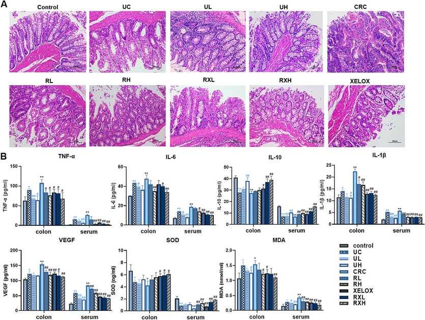 H&E staining results of colon tissues (200 × magnification) (A); Bar chart of ELISA kit results for inflammatory factors, tumor factors and antioxidant indicators (B). Values shown are means ± SD. *p < 0.05, **p < 0.01 UC vs Control group; *p < 0.05, **p < 0.01 CRC vs Control group; #p < 0.05, ##p < 0.01 vs UC group; #p < 0.05, ##p < 0.01 vs CRC group.