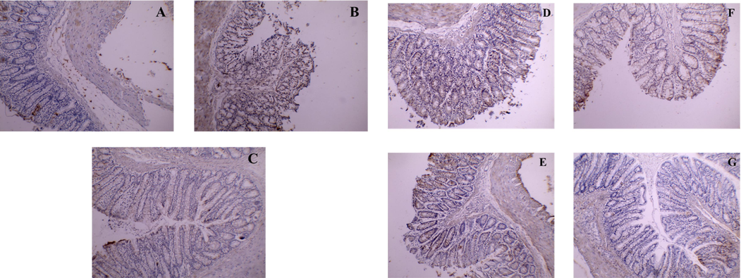 Caspase-3 immunostaining. A) Shows control caspase-3 expression (Group I), brown color indicates specific immunostaining of cleaved caspase-3 and light blue color indicates nuclear hematoxylin staining. B) The colonic section of acetic-acid-induced colitis (Group II) depicts numerous cells with a strong positive mainly nuclear caspase-3 reaction. C) The colonic section of the sulfasalazine-treated group (Group III) shows a near-control caspase-3 expression. D) The colonic section of the pretreated group with a low dose (Group IV); shows multiple cells with a moderately positive cytoplasmic caspase-3. E) The colonic section of the pretreated group with a high dose (Group V); reaction reveals few cells with a weak positive cytoplasmic caspase-3 reaction. F) The colonic section of the treated group with a low dose (Group VI); shows multiple cells with a moderately positive cytoplasmic caspase-3. G) The colonic section of the treated group with a high dose (Group VII); shows a near-control caspase-3 expression.[Original magnification: 40x].