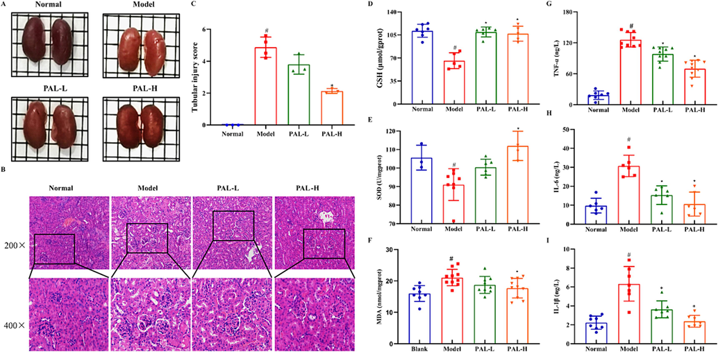 Effect of palmatine (PAL) on renal tissue pathology, oxidative stress indicators and inflammatory factors in the CIAKI mice model. The renal appearance of palmatine was similar to that of the normal group (A). HE staining showed significant changes in the renal tissue structure of the model group, while palmatine alleviated these changes (scale bar, 20 μm, B). The renal tubular injury score in HE was quantitatively analyzed according to the lesion (C). Indicators of oxidative stress including GSH (D), SOD (E) and MDA (F) in the kidney were apparently regulated in the model group, but were restored to normal levels by palmatine treatment. The concentrations of TNF-α (G), IL-6 (H) and IL-1β (I) in kidney were significantly increased in the model group, while palmatine restored them to normal levels. #p < 0.05 vs normal group, *p < 0.05 vs model group.