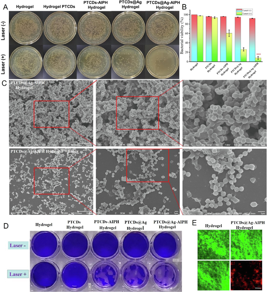 (A) The plate photos of S. aureus biofilm cocultured with different Hydrogel groups with or without 660 nm laser irradiation. (B) The killing effect of the different Hydrogels against S. aureus biofilm (***P＜0.001, vs Hydrogel group); (C) The SEM images of S. aureus biofilm cocultured with PTCDs@Ag-AIPH Hydrogel with or without laser irradiation, Scale bar = 1 μm; (D) Microscopy images of crystal violet-stained S. aureus biofilms; (E) The specific killing effects of S. aureus biofilm with various treatments by live/dead staining. Scale bar = 20 μm.