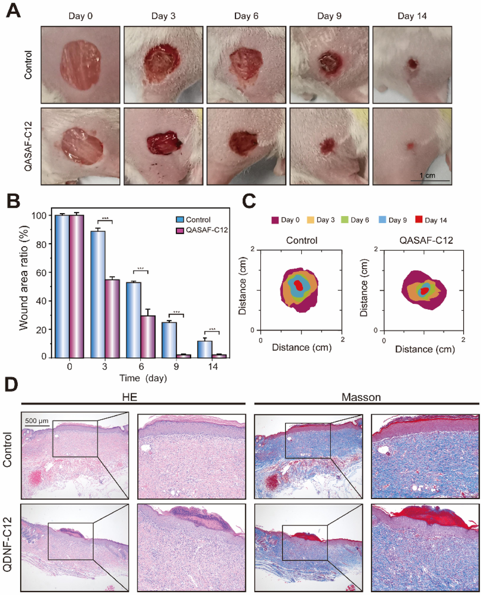 (A)Wound healing, (B) wound healing ratio, and (C) wound healing area of mice in the wound healing model. (D) Tissue section H&E and Masson staining of mouse epidermis in wound healing model. All data are presented as the means ± SD (n = 3). (**p < 0.01). Bar = 500 μm.